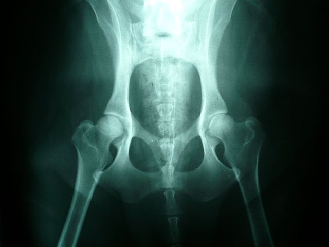 Canine Hip Dysplasia in Dogs, Normal Hips